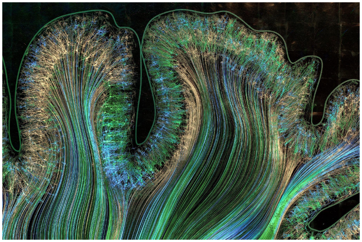 Golden neurons and flowing axon bundles in motor and parietal cortex, from the artwork Self Reflected