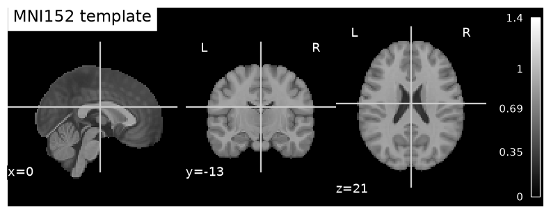 Sagittal, coronal, and axial slices through the MNI152 anatomical template with crosshairs at the cut coordinates