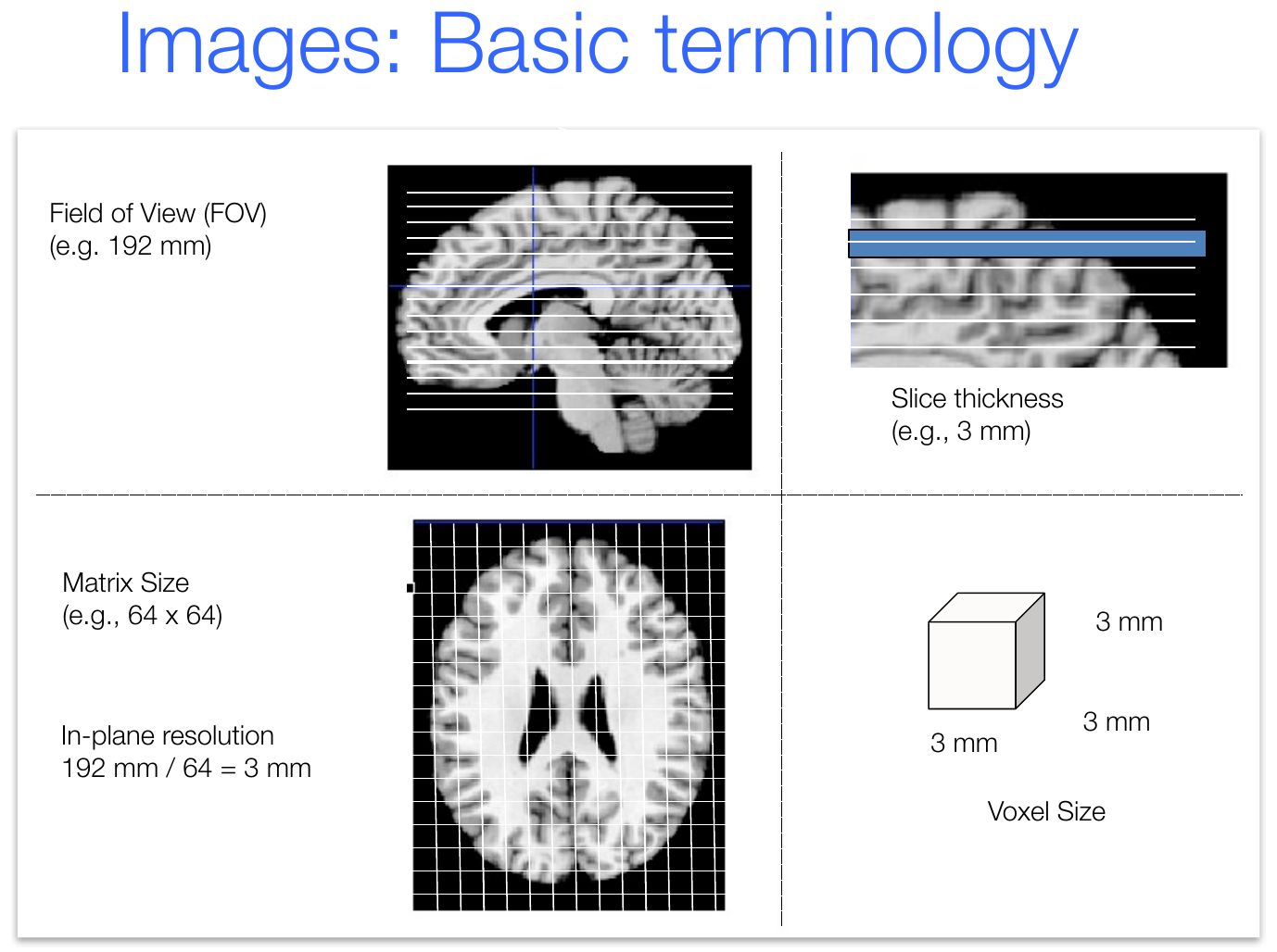 Field of view, slice thickness, matrix size, in-plane resolution, and voxel size illustrated on brain slices