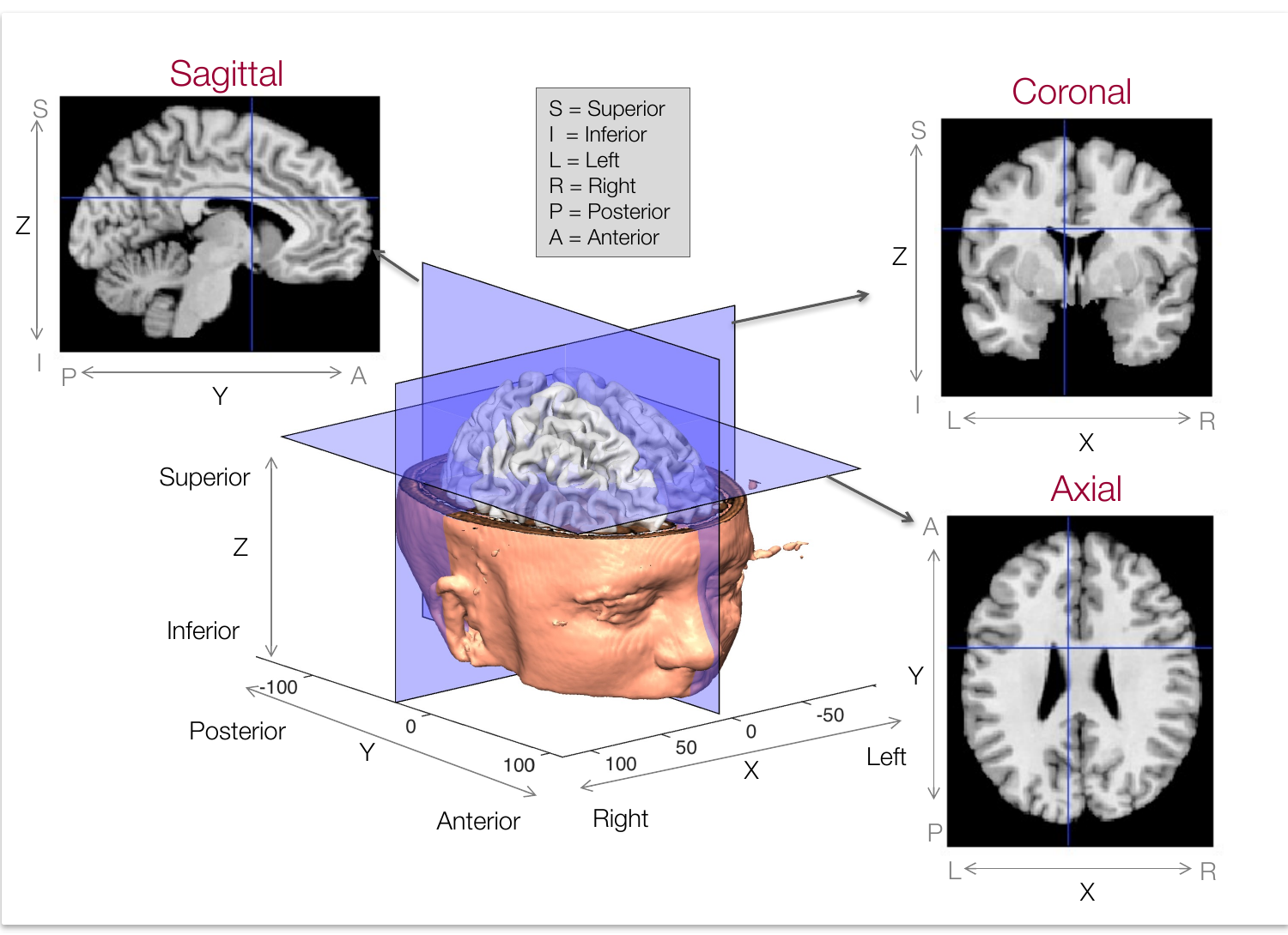 Sagittal, coronal, and axial slice orientations with x, y, and z axis labels on a 3-D head rendering