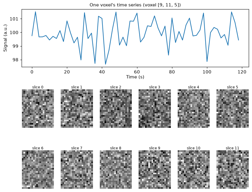 A noisy simulated voxel time series plotted over two minutes, above a montage of twelve noisy axial slices