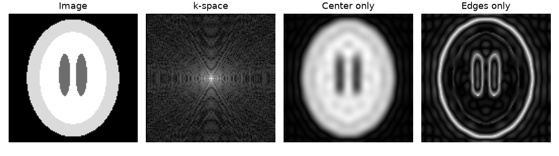 Head phantom, its k-space magnitude, a blurry reconstruction from the k-space center, and an edge-only reconstruction from the k-space periphery