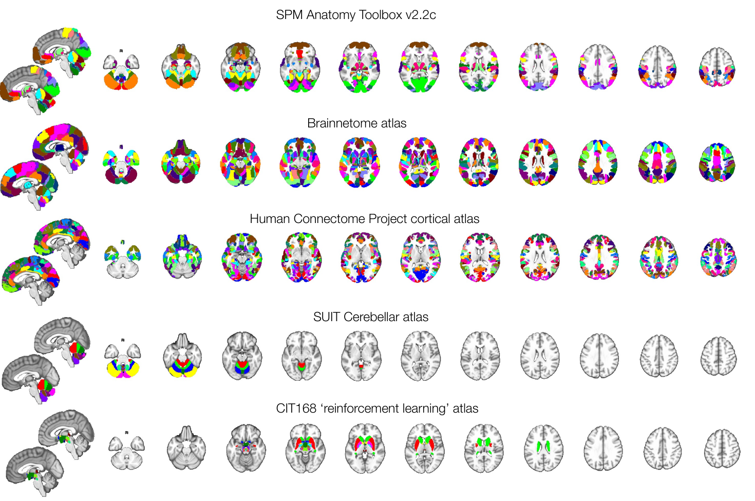 Five brain atlases displayed on the same MNI152 slices, from the SPM Anatomy Toolbox to the CIT168 subcortical atlas
