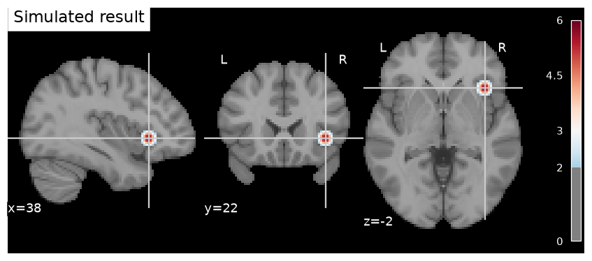 Simulated activation focus at MNI coordinate (38, 22, -2) shown on orthogonal slices of the MNI152 template
