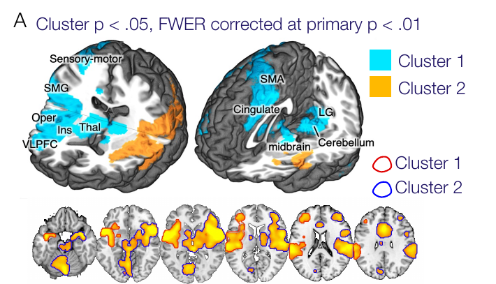 Cluster extent-based thresholding and its limitations. In an analysis of pain-related activity, a liberal primary threshold (p < 0.01 uncorrected) yields widespread activation that forms two clusters significant by FWER-corrected cluster extent (p < 0.05, outlined). The valid inference is only that each cluster contains at least one truly active voxel somewhere within it — the true activation could lie in many different structures, and a substantial fraction of the colored voxels are expected to be false discoveries. (Panel A of Figure 22.2 from the book. © the authors and MIT Press; reproduced with permission — not covered by this site’s CC-BY license.)