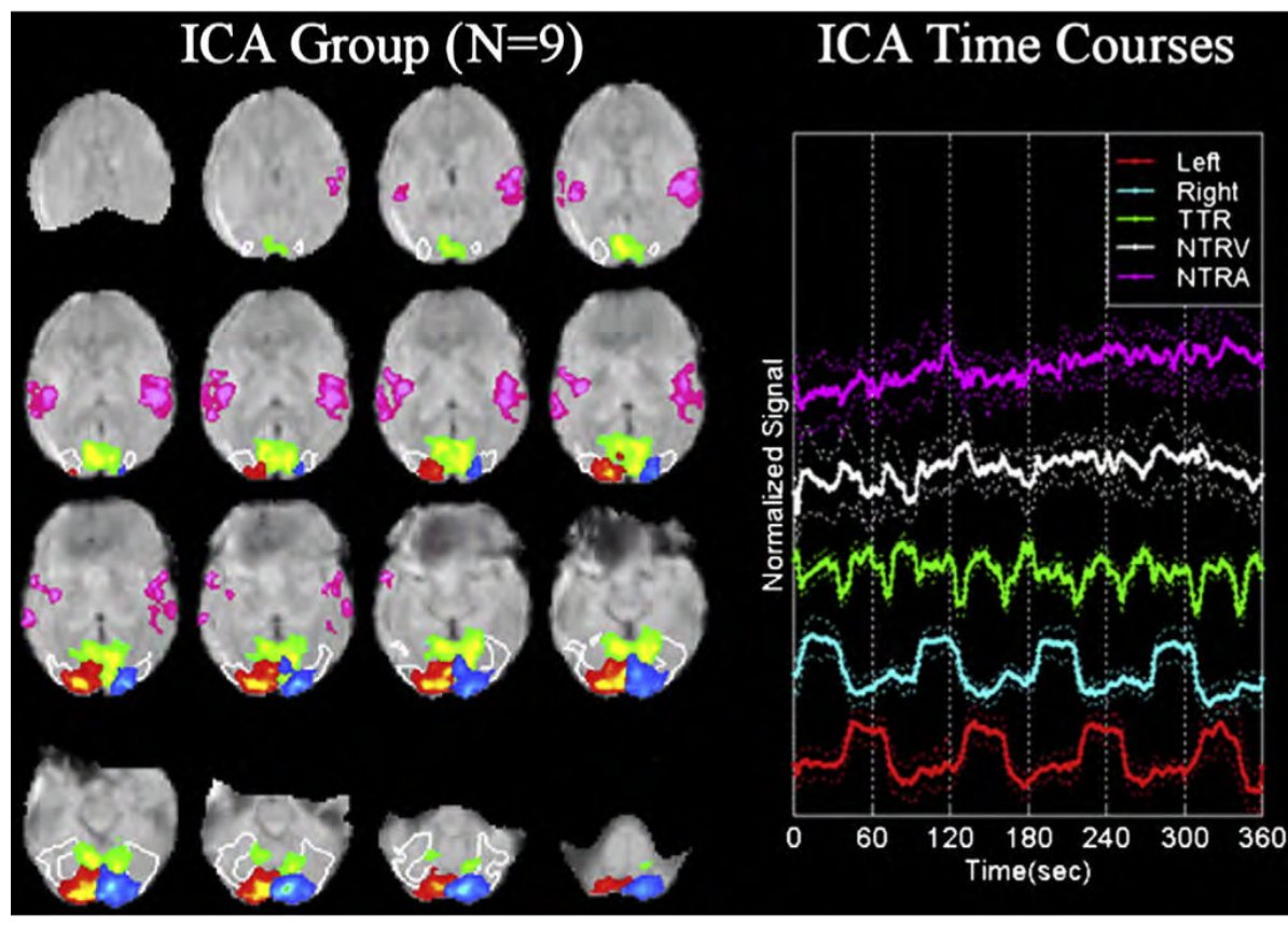 Group ICA component maps and their task-related time courses