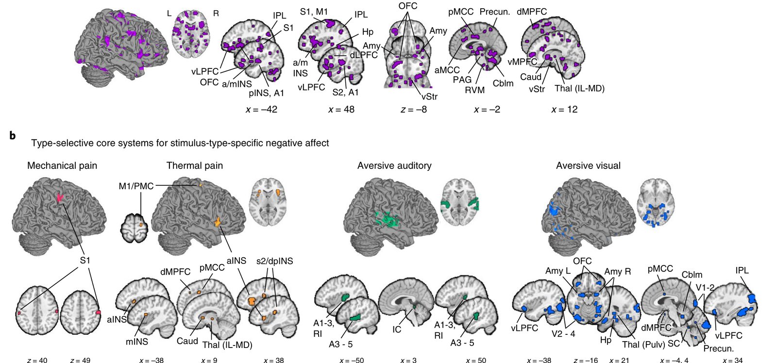 Common and stimulus-specific negative affect representations across the brain