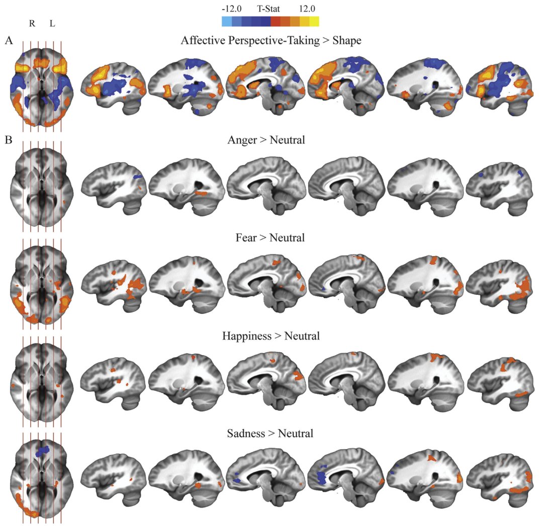 Affective perspective-taking activation maps by emotion