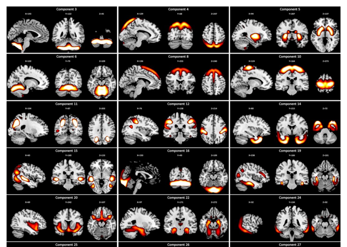 Source-based morphometry gray matter components predicting recidivism