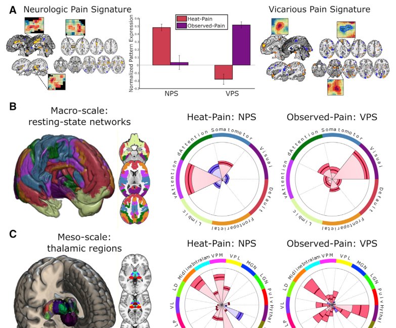 Neurologic Pain Signature vs vicarious pain signature across networks and thalamus