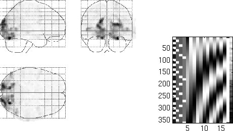 SPM glass-brain projections and design matrix