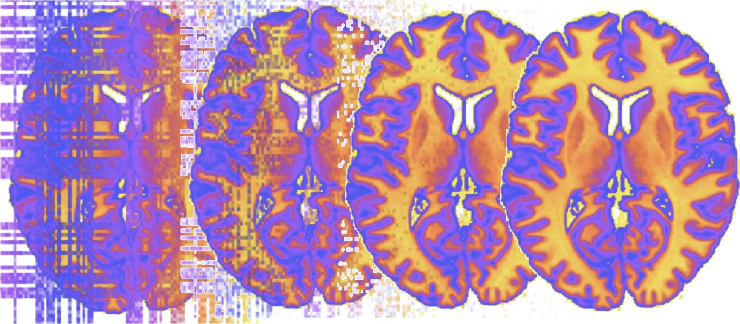 Axial brain slices in a false-color map