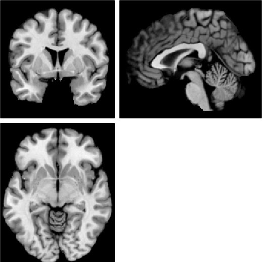Coronal, sagittal, and axial anatomical slices
