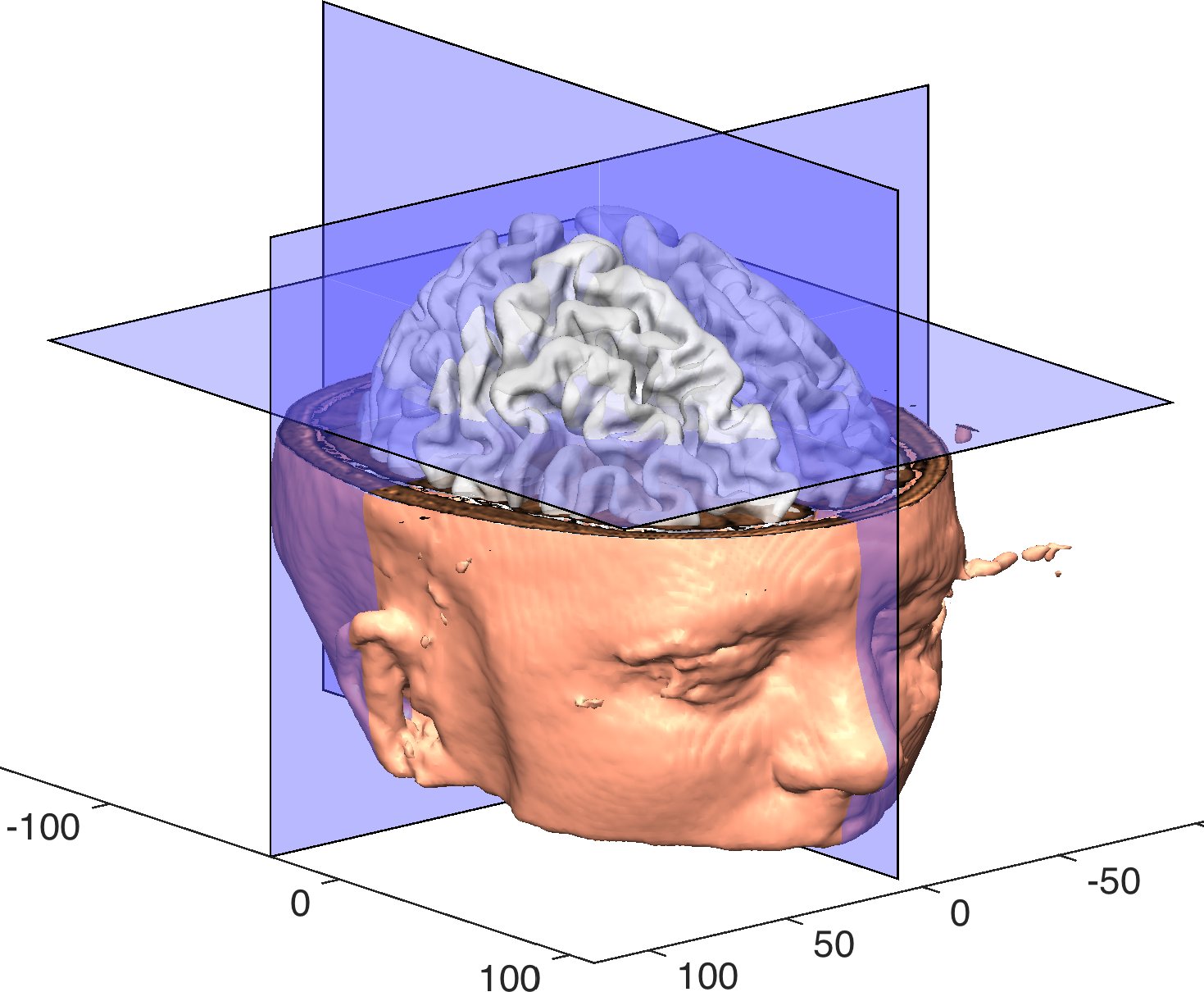 3-D head rendering with orthogonal slice planes