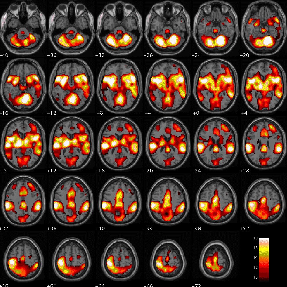 Axial montage of group activation maps