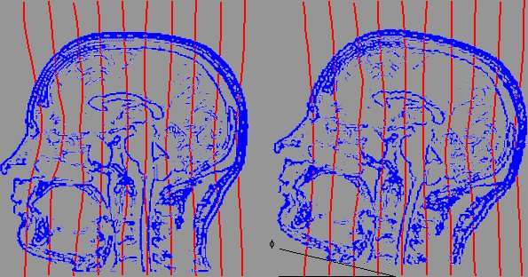 Head contour overlays before and after coregistration