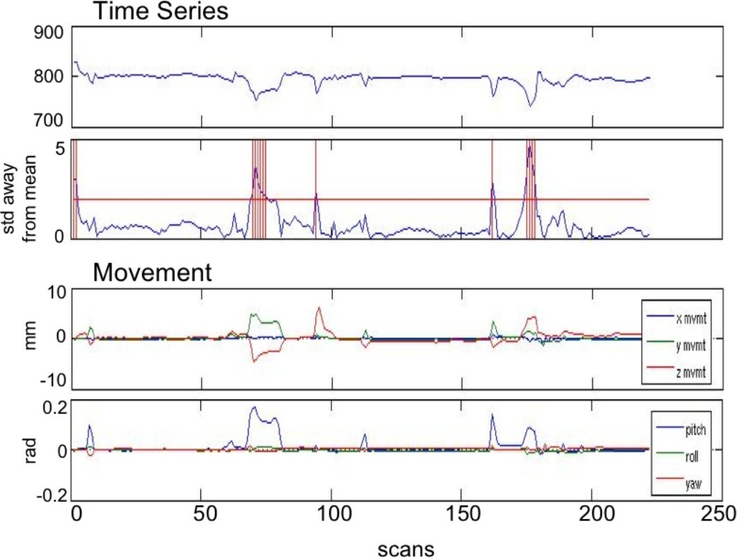 Artifact detection: time series and motion traces