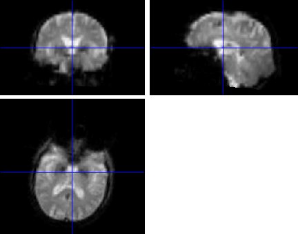 Orthogonal views of a smoothed functional volume
