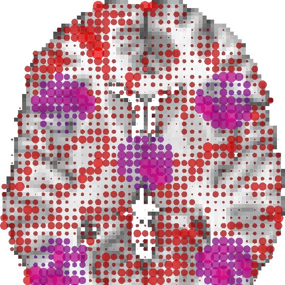 Voxel-wise effects across an axial brain slice