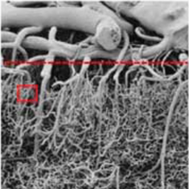 Micrograph of cortical vasculature