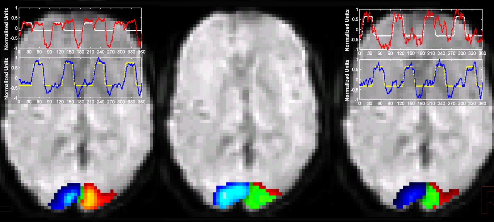 ICA component maps with associated time courses on brain slices