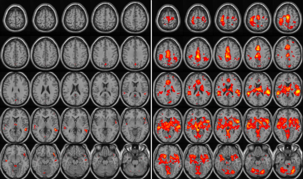 Activation gained by adding the temporal derivative term