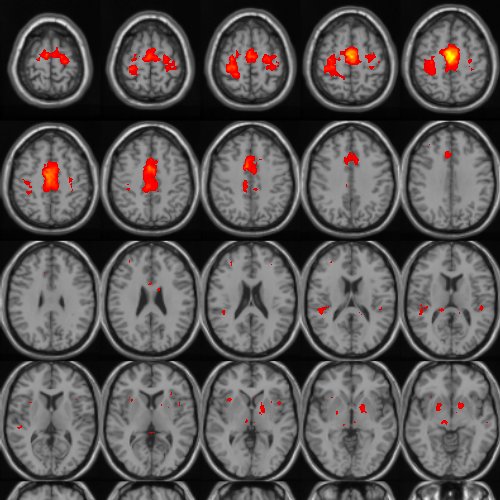 Axial montage of derivative-boosted t statistics