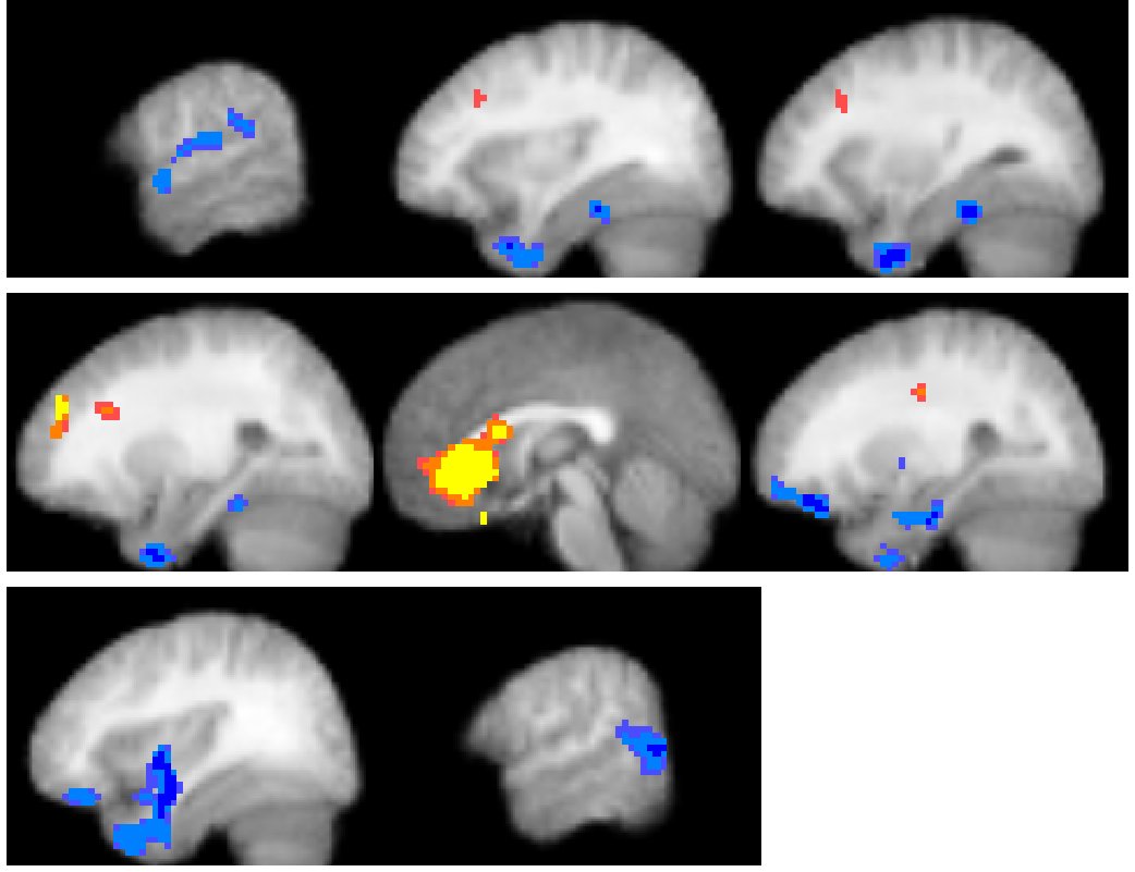 Mediation path maps on sagittal and axial brain slices