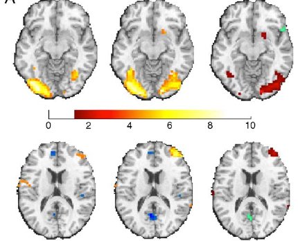 OLS versus robust (IRLS) group maps and their difference