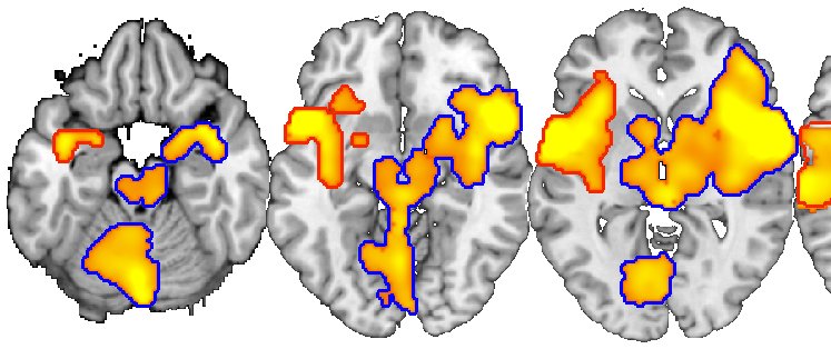 Montage of axial slices with thresholded activation