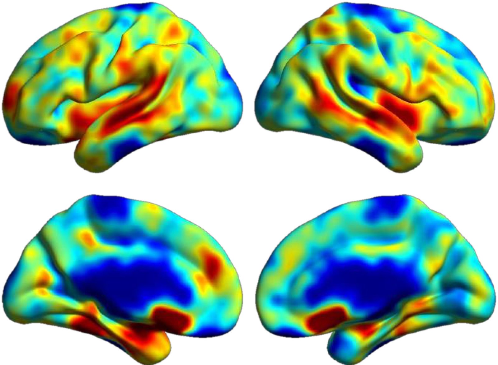 ICA component loadings mapped onto lateral and medial cortical surfaces