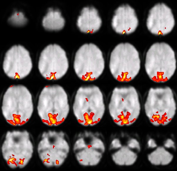 Spatial ICA component maps on grey axial slices (GIFT output)