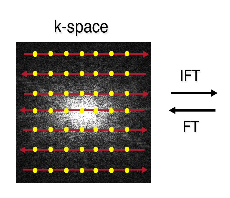 k-space sampling and Fourier reconstruction to image space