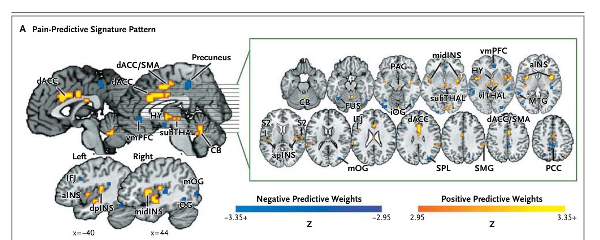 Neurologic Pain Signature predictive weight map