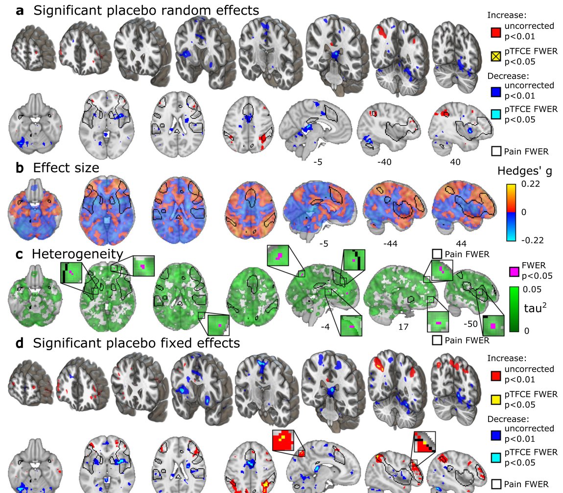 Participant-level meta-analysis maps of placebo analgesia effects